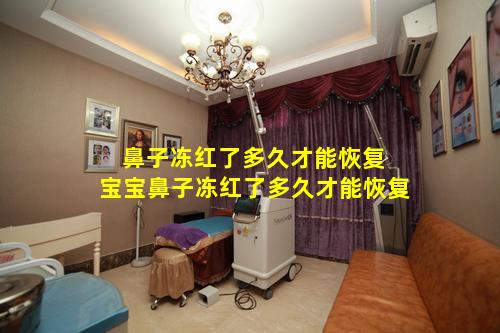 鼻子冻红了多久才能恢复 宝宝鼻子冻红了多久才能恢复